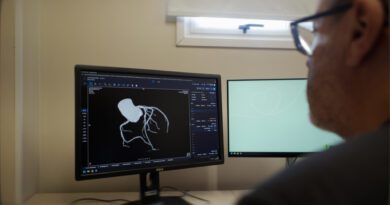 Unimed Serra Gaúcha implementa IA no apoio a laudos de tomografia