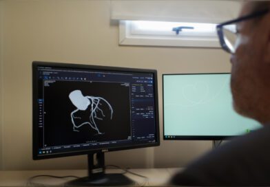 Unimed Serra Gaúcha implementa IA no apoio a laudos de tomografia